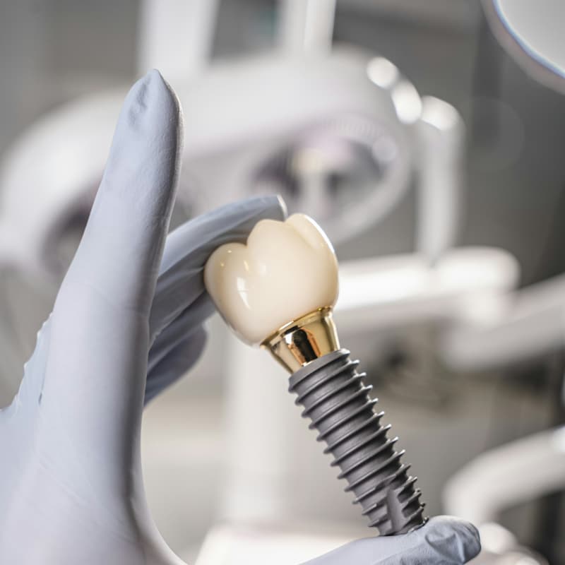 Willow Smiles Dental — New Patient Exam & Cleaning